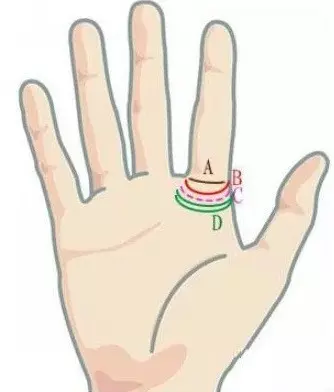 Кольцо Соломона на руке