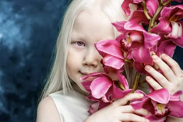 Девушка-альбинос с цветами