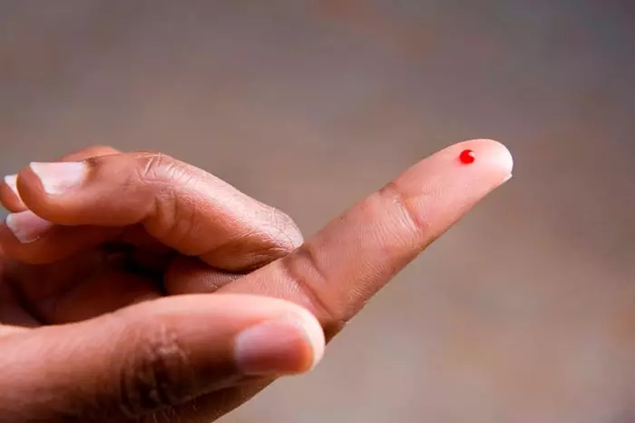 кровь из укола пальца